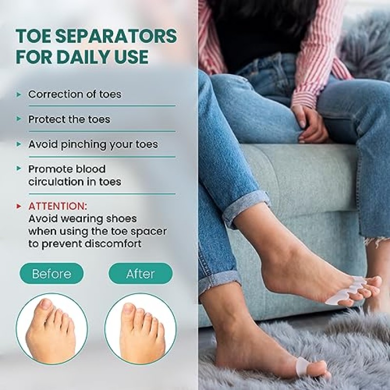 Welnove 발가락 스페이서 건막류 교정기 - Hammertoes, 여성용 남성용 건막류 패드, 요가 연습에 적합한 티 트리 오일 주입 젤 발가락 분리기 8개