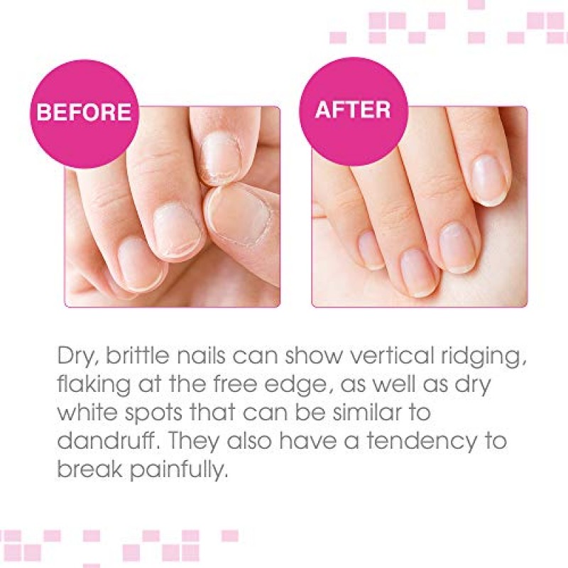 Nail Tek Protection Plus 3, 단단하고 부서지기 쉬운 손톱을 위한 손톱 강화제, 0.5oz, 1팩
