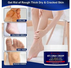 건조하고 갈라진 발을 위한 BeaGirl 요소 크림 40% + 2% 살리실산 + 히알루론산 - 인텐시브 굳은 살 제거 크림 - 갈라진 발 뒤꿈치 회복 크림 - 피부에 효과적으로 활력을 불어넣습니다 5.29 fl.oz