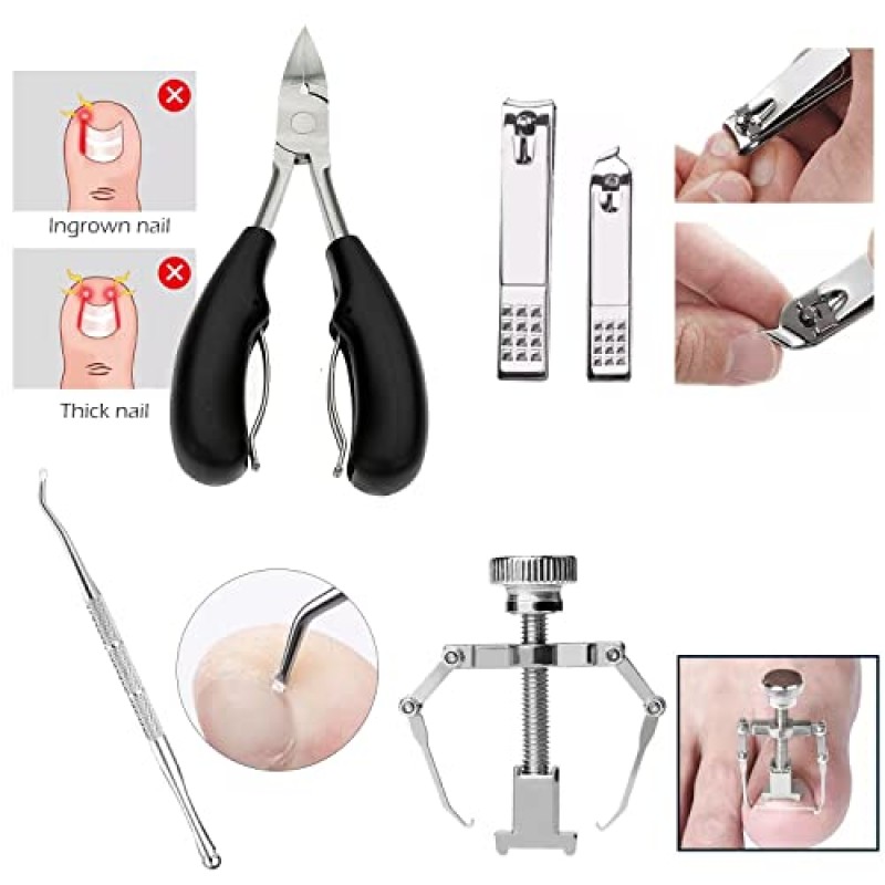 자란 발톱 깎기 키트(7PCS), 두꺼운 손톱 발톱 관리 도구, 스테인레스 스틸 페디큐어 도구에는 PU 가죽 가방이 달린 손톱 리프터 손톱 교정기가 포함됩니다.