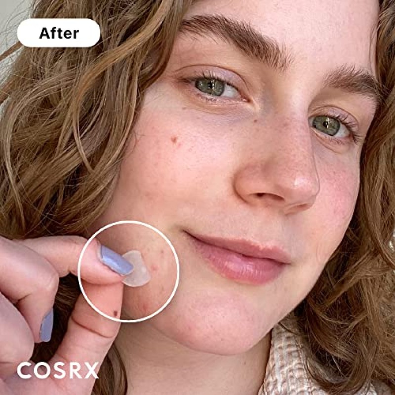 COSRX 여드름 여드름 패치(96개) 흡수성 하이드로콜로이드 스팟 트리트먼트 빠른 치유, 잡티 커버, 세 가지 크기