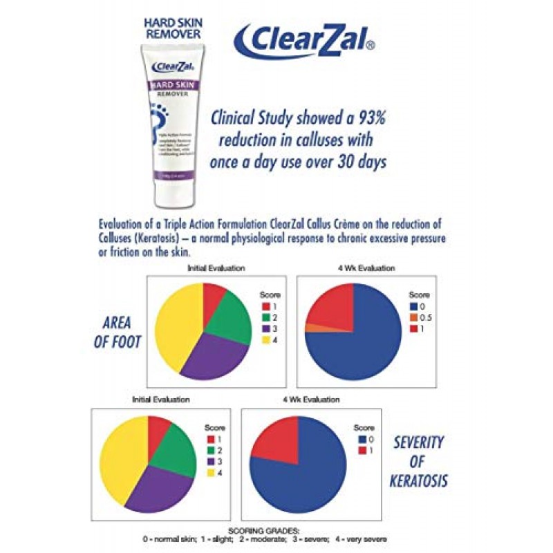 딱딱한 피부를 위한 Clearzal 풋 크림은 부드럽고 매끄러운 피부를 유지하면서 굳은살과 티눈 제거에 도움을 주며, 알로에 베라가 함유된 트리플 액션 포뮬러, 3.4온스 튜브에 수분을 공급하고 컨디셔닝합니다.