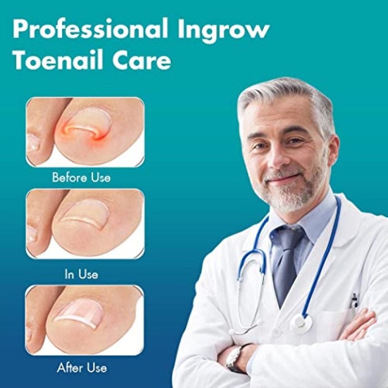 Tokokimo 두꺼운 손톱용 발톱깎이, 5개입 자란 발톱깎기 세트 노인을 위한 스테인레스 스틸 발톱깎기 헤비 듀티 롱 핸들 두꺼운 손톱깎이 내향성 발톱깎기 크리스마스 선물