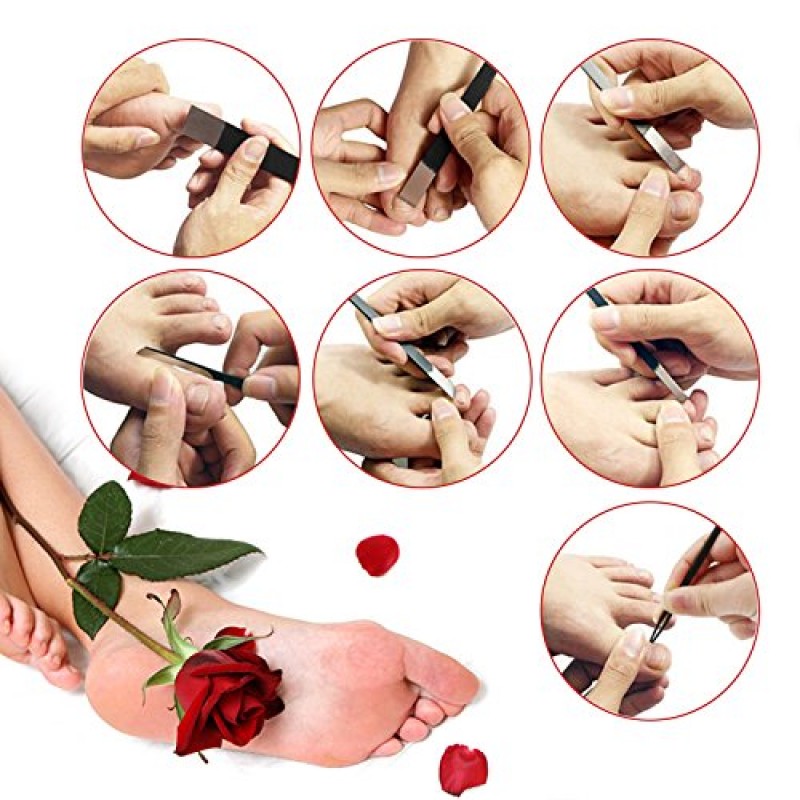 발용 페디큐어 나이프 세트, Segbeauty 7pcs 보관 가방이 포함된 자란 발톱 블레이드 도구, 고망간 강철 네일 나이프 큐티클 리무버, 네일 옥수수 캘러스용 전문 발 수리 날카로운 블레이드 키트