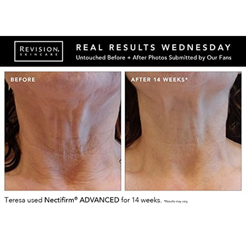 Revision Skincare Nectifirm Advanced 넥 퍼밍 크림, 목과 데콜테의 중등도 및 고급 노화를 해결하고 지방 조직과 주름진 피부를 줄이고 잔주름과 주름을 줄여줍니다. 1.7oz