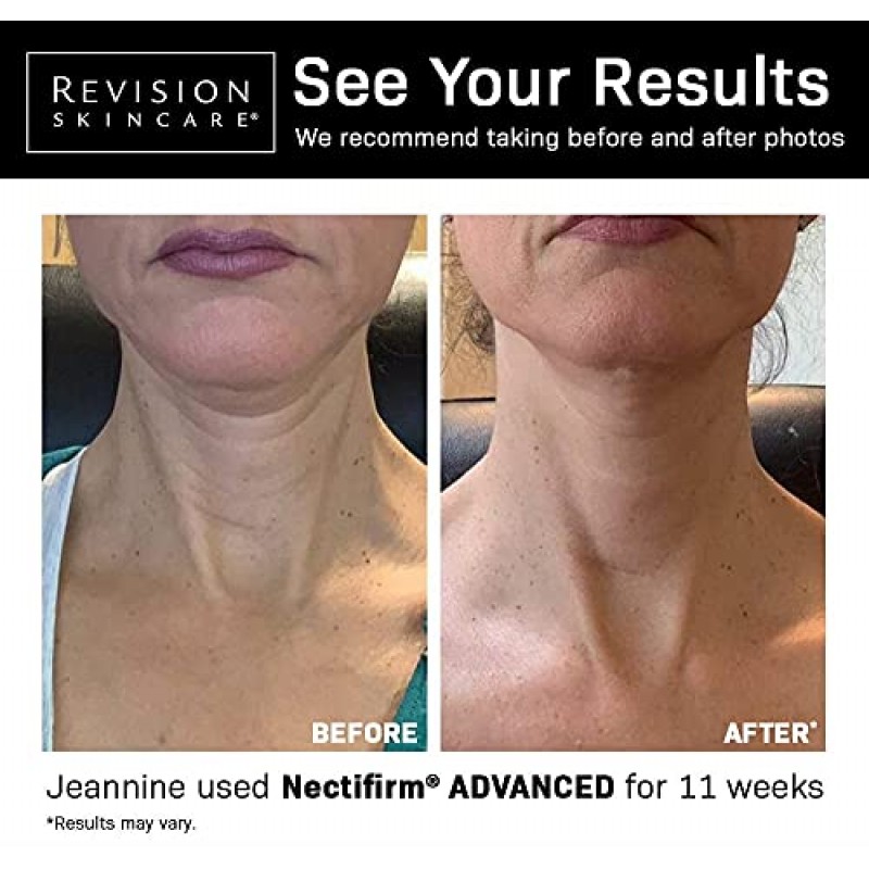 Revision Skincare Nectifirm Advanced 넥 퍼밍 크림, 목과 데콜테의 중등도 및 고급 노화를 해결하고 지방 조직과 주름진 피부를 줄이고 잔주름과 주름을 줄여줍니다. 1.7oz