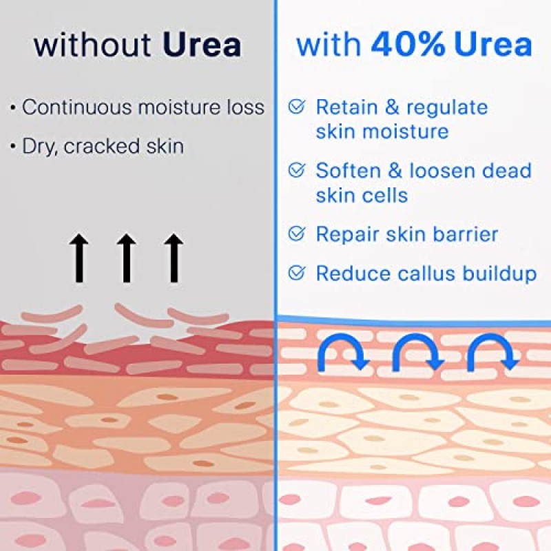 에바넬 우레아 크림 40% 살리실산, 건조하고 갈라진 발을 위한 6팩 발 크림 발뒤꿈치 무릎 팔꿈치 손 수리 트리트먼트, 발 모이스처라이저 옥수수 각질 제거제 발용 발톱 연화제
