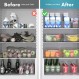뚜껑이 있는 쌓을 수 있는 냉장고 정리함 7개 세트, 냉장고 정리 및 보관용 투명 용기, 과일, 야채, 식품, 음료용 BPA 프리 플라스틱 식료품 저장실