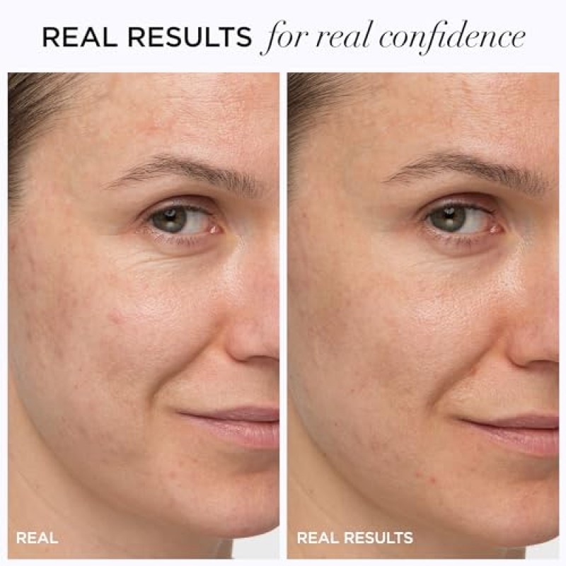 IT Cosmetics Confidence in a Cream 안티 에이징 페이스 모이스처라이저 – 2주 만에 잔주름, 주름, 노화 피부 징후를 눈에 띄게 감소, 히알루론산, 나이아신아마이드가 함유된 48HR 수분 공급