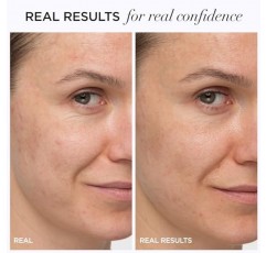 IT Cosmetics Confidence in a Cream 안티 에이징 페이스 모이스처라이저 – 2주 만에 잔주름, 주름, 노화 피부 징후를 눈에 띄게 감소, 히알루론산, 나이아신아마이드가 함유된 48HR 수분 공급