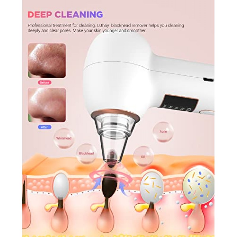 2023 업그레이드된 UJhay 블랙헤드 리무버 모공 진공 - 남성 및 여성용 여드름 추출기 도구 - 3개의 흡입력, 5개의 프로브 및 핫 압축 기능을 갖춘 USB 충전식 얼굴 모공 클리너