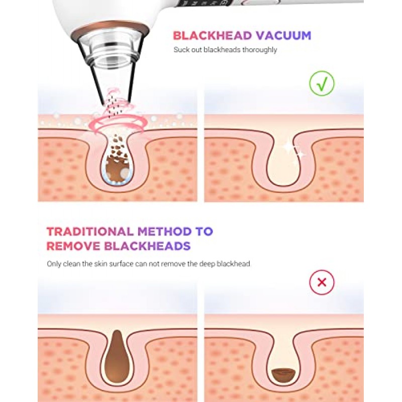 2023 업그레이드된 UJhay 블랙헤드 리무버 모공 진공 - 남성 및 여성용 여드름 추출기 도구 - 3개의 흡입력, 5개의 프로브 및 핫 압축 기능을 갖춘 USB 충전식 얼굴 모공 클리너