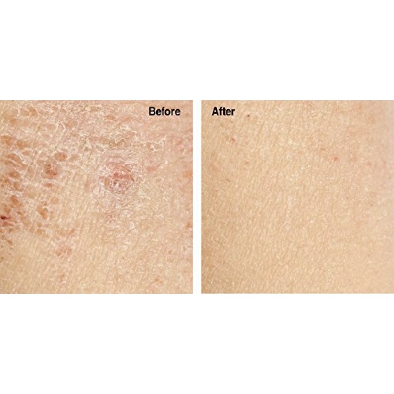 Advanced Clinicals 럭셔리 퓨어 아르간 오일. 가벼운 페이셜 오일로 주름을 완화하고 건조한 피부에 수분을 공급합니다.