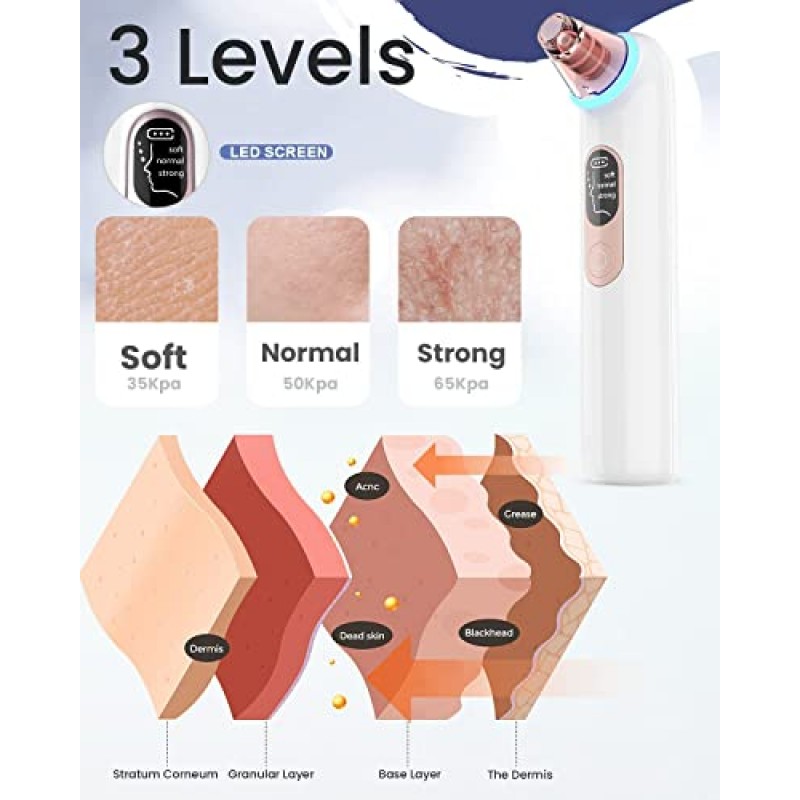 블랙헤드 제거제 모공 진공 여드름 추출기: 블루 라이트가 포함된 업그레이드된 모공 클렌저 - 얼굴용 충전식 블랙 헤드 제거제, 화이트헤드 제거, 얼굴 퍼밍, 여성 및 남성을 위한 오일 감소