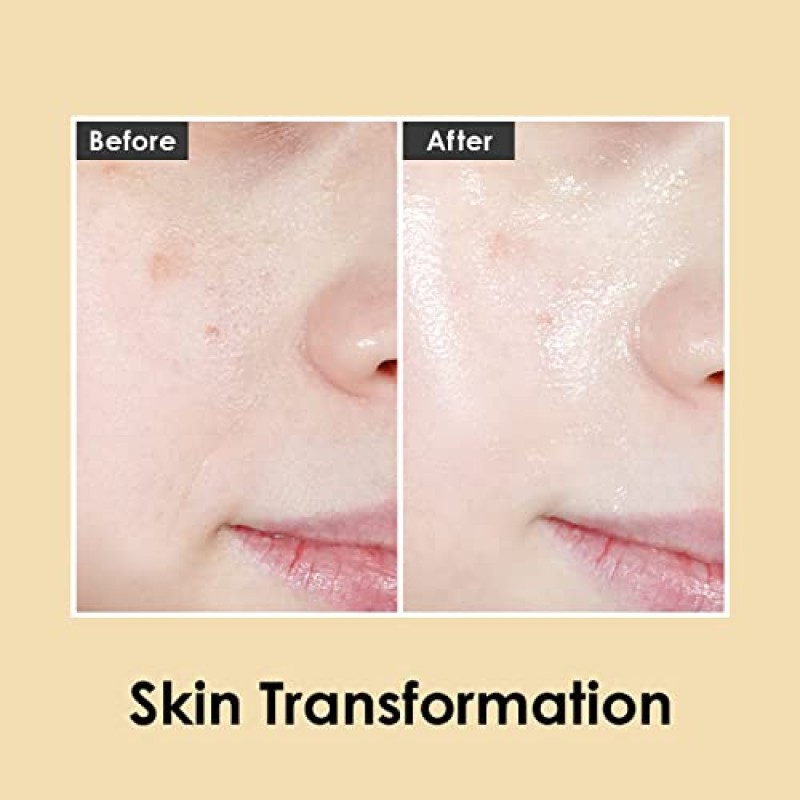 메디필 퓨어 골드 24K 앰플 3.38 fl.oz / 100ml | 99.9% 24K 순금 올인원 앰플, 5가지 생기추출물이 수분손실을 최소화하고, 브라이트닝 | 모든 피부 타입을 위한 한국 스킨케어