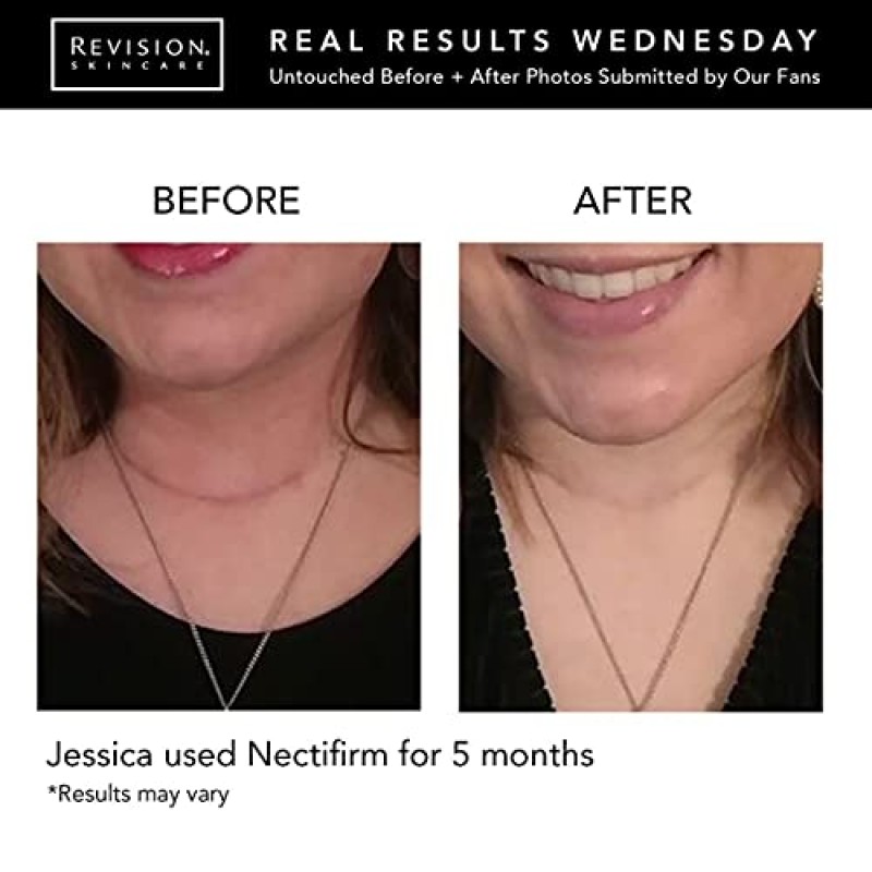 리비전 스킨케어 넥티펌(Revision Skincare Nectifirm)은 목과 데콜테에 나타나는 조기 및 중간 정도의 노화 징후를 타겟으로 하며, 목과 턱선을 더욱 탄탄하고 끌어올리도록 돕고, 잔주름과 주름을 개선합니다.