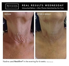 리비전 스킨케어 넥티펌(Revision Skincare Nectifirm)은 목과 데콜테에 나타나는 조기 및 중간 정도의 노화 징후를 타겟으로 하며, 목과 턱선을 더욱 탄탄하고 끌어올리도록 돕고, 잔주름과 주름을 개선합니다.