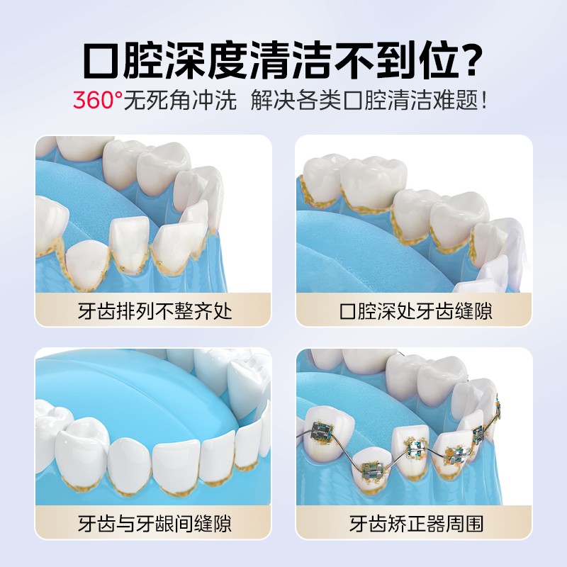Midea 치과 린서, 가정용 치과 세정제, 교정용 특수 물 치실, 전기 휴대용 구강 세정기, 작은 푸른 고래