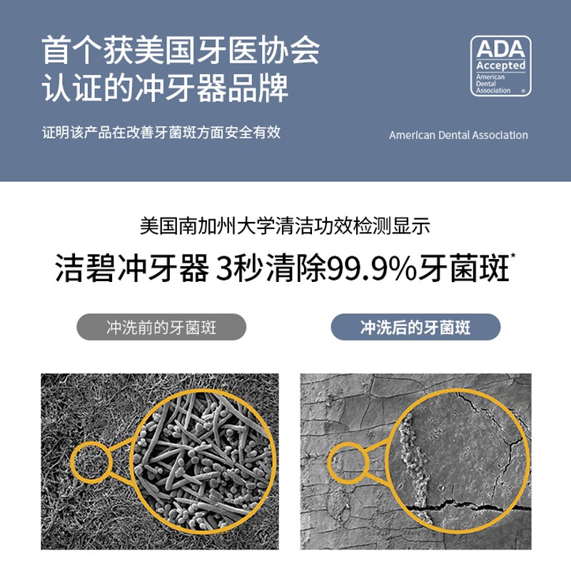 Jiebi 치아 린서 GT0 치열 교정 가정용 물 flosser 데스크탑 플러그인 구강 청소 waterpik 치아 클리너 GT3
