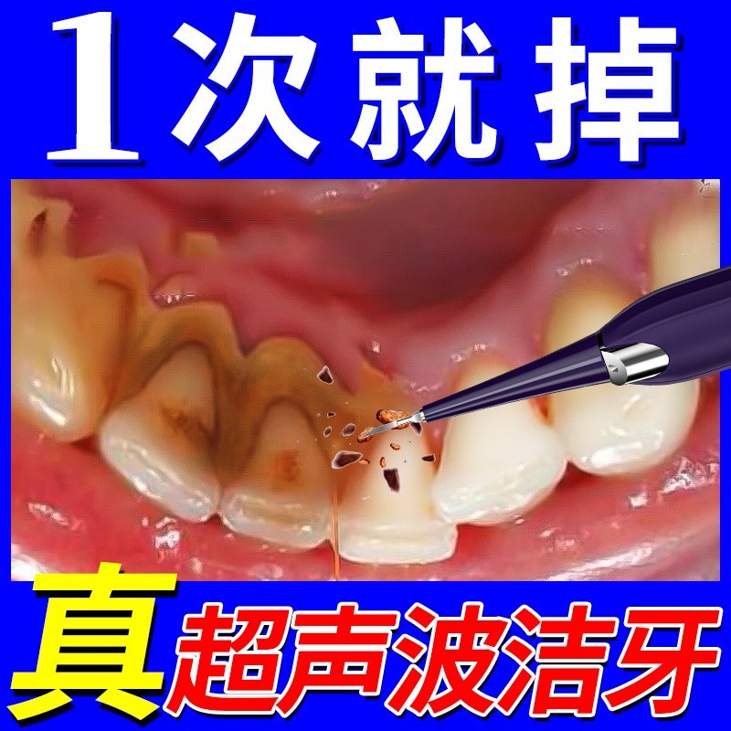 초음파치석제거제, 치아세정제, 치아얼룩제거제, 치석황치얼룩제거제, 치아린서, 청소유물