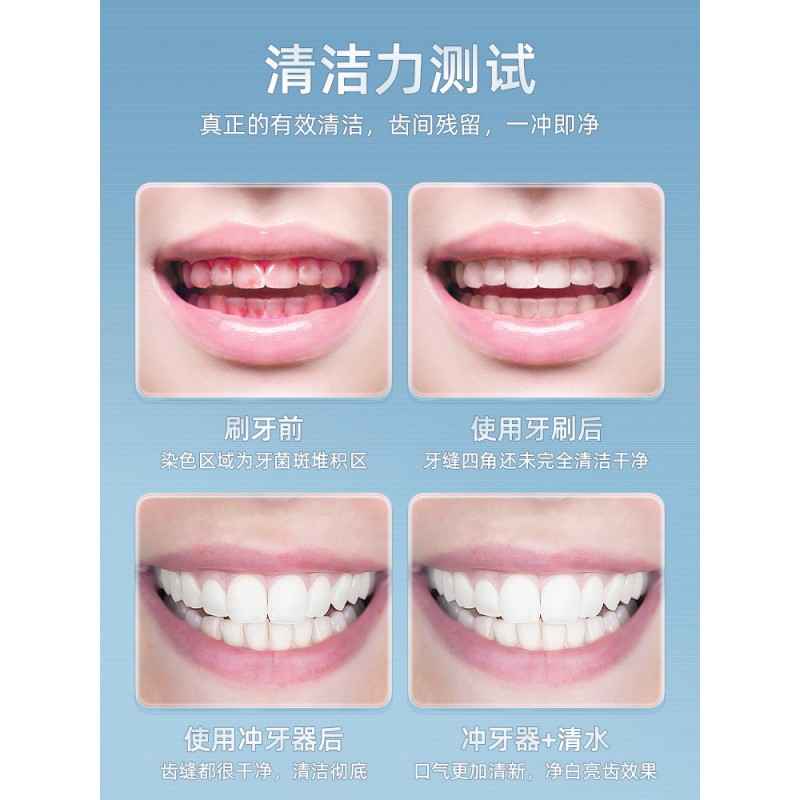 전동치과린저, 가정용구강청소, 치아청소, 휴대용 물치실, 교정특수품 A812