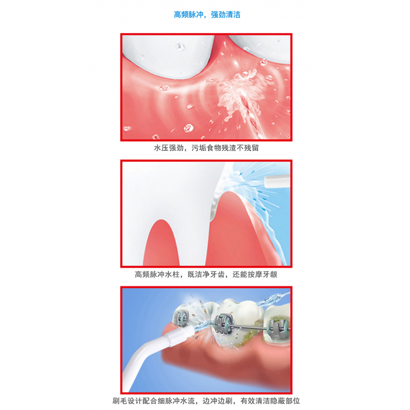 정통 거대 ​​휴대용 스마트 치아 린스 호스트 + 노즐 전체 패키지, 무료 배송