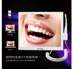 구강 내 카메라, 고화질 사진 검사 치과 도구, 17인치 WIFI 치과 디지털 뷰어 올인원 기계