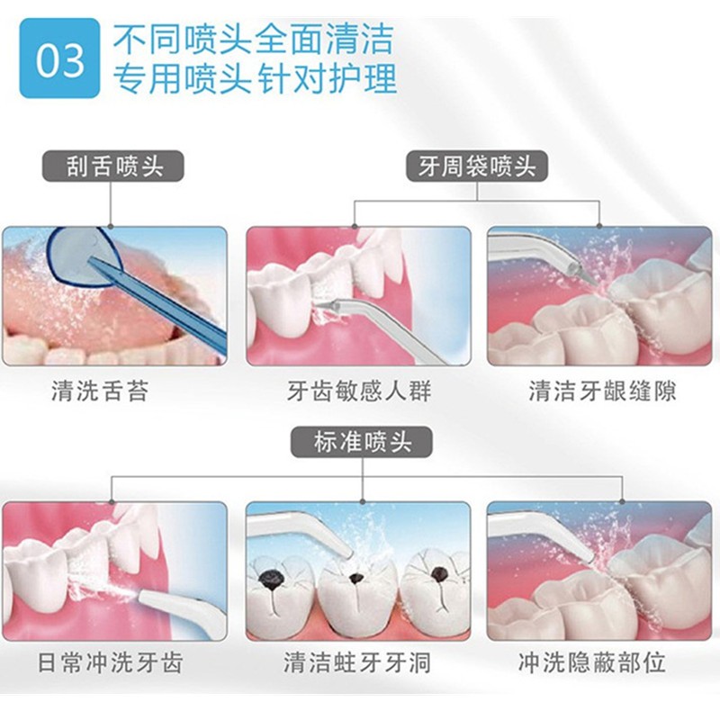 전기 치과 린서, 가정용 물 치실, 고전압 펄스, 치열 교정 청소, 사랑니 치간 청소, 데스크탑 플러그인