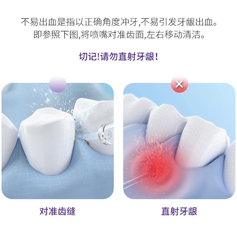 치아세정기, 가정용 치아세정기, 휴대용 치실, 전동치아세척, 치아교정 특수세정, 치간구강세정제