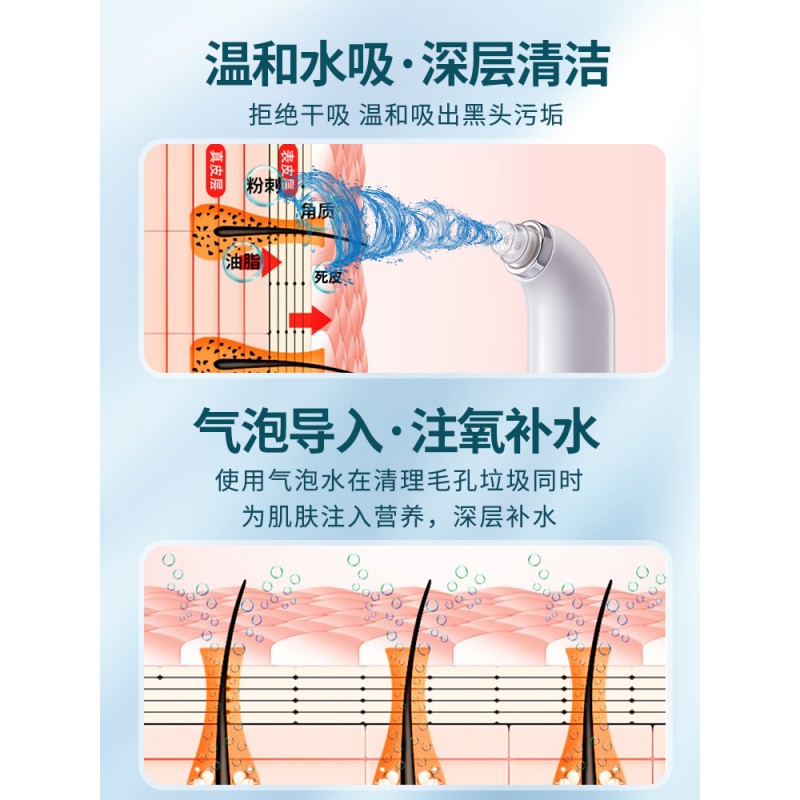 작은 버블 미용기구, 블랙헤드 흡입도구, 페이셜 클렌징 모공 도구, 전동 블랙헤드 제거 및 여드름 흡입 장치