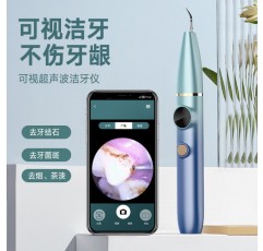 구강 치아 먼지를 청소하고 치석을 제거하는 시각 치석 제거제 초음파 치아 세척 도구