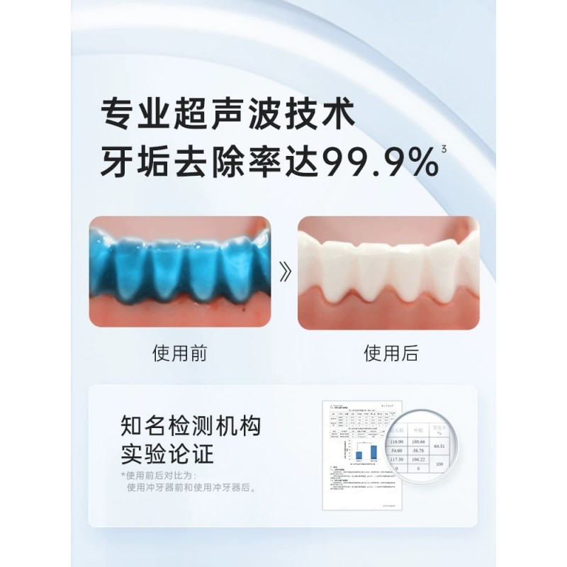 독일 수입 전동 치아 세정제, 휴대용 치아 세정제, 가정용 미적분학 치아 인공물, 물 치실, 치열 교정