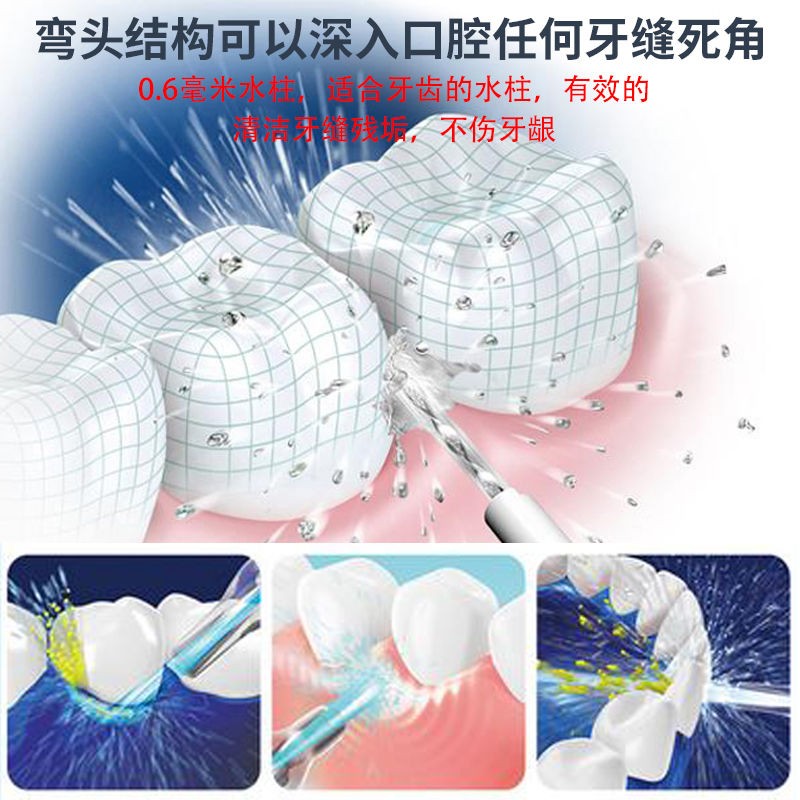 편리한 치아세정제, 가정용 치아세정제, 세정제, 휴대용 특수구강세척수, 치실, 치석, 구강관리