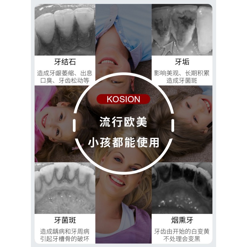 Kosion 초음파 치과 스케일러 가정용 치과 미적분 제거 유물 치아 클리너 스케일 제거 애완 동물 고양이와 개 전기