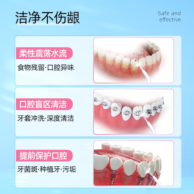치과 린서, 가정용 물 치실, 휴대용 치과 린스, 구강 스탬핑, 치열 교정 치주 세척기 클리너