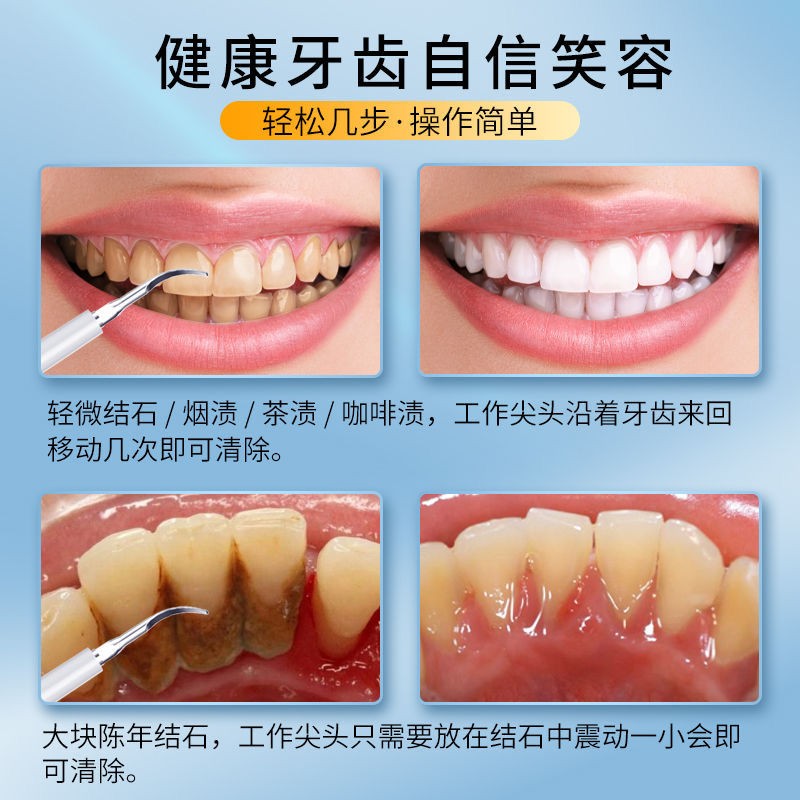 2023 초음파 치아 클리너 치과 미적분 제거 치아 얼룩 제거 빠른 작용 치아 청소 유물의 새로운 강력한 버전