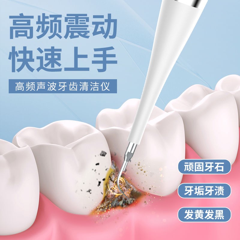 2023 초음파 치아 클리너 치과 미적분 제거 치아 얼룩 제거 빠른 작용 치아 청소 유물의 새로운 강력한 버전
