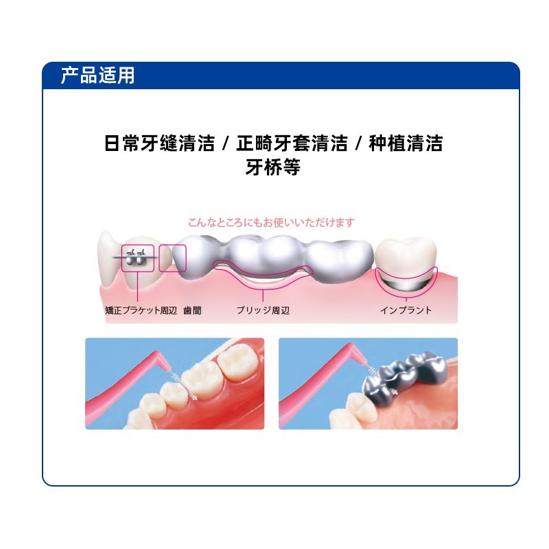 일본 라이온 킹 치간 칫솔 치열 교정 L 자형 치간 칫솔 치아 틈새 칫솔질 틈새 칫솔 교정기 청소 교정