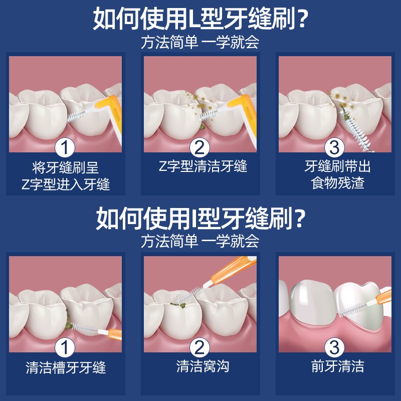 폰엄마 치아교정용 치간칫솔, 부드러운 모의 수입와이어 치간칫솔, 성인용 치간칫솔, 총 30개, 무료배송