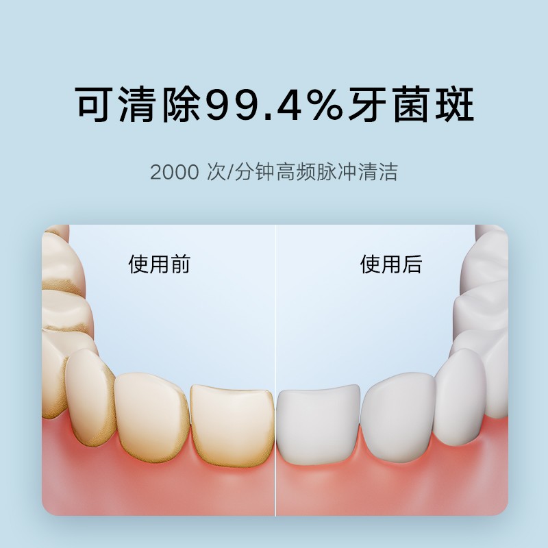 Xiaomi 전기 치아 Flosser F300 휴대용 치간 세정기 치아 물 Flosser 홈 구강 청소 유물