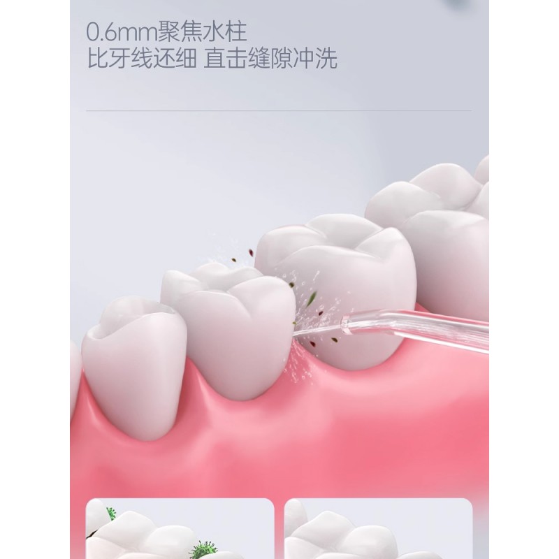 Xiaomi Youpin 생태 체인 브랜드 Xiaoshi 치과 린서 전기 휴대용 가정용 물 flosser 치석을 제거하는 치아 클리너