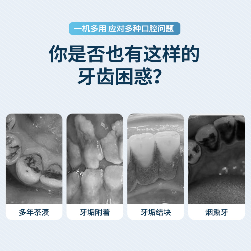 Yueerwanwan 초음파 치아 청소기 가정용 전기 치아 린스는 치과 미적분을 제거하고 연기 얼룩을 청소합니다 치아 청소 도구